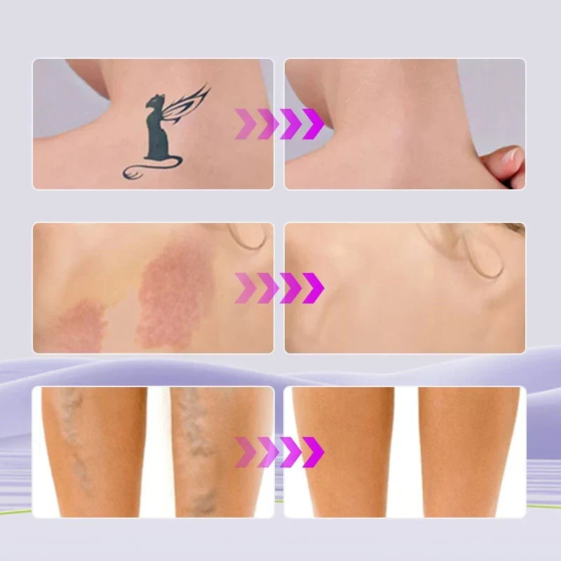 Covrané™ Voděodolný tělový make-up pro hladkou a sjednocenou pleť