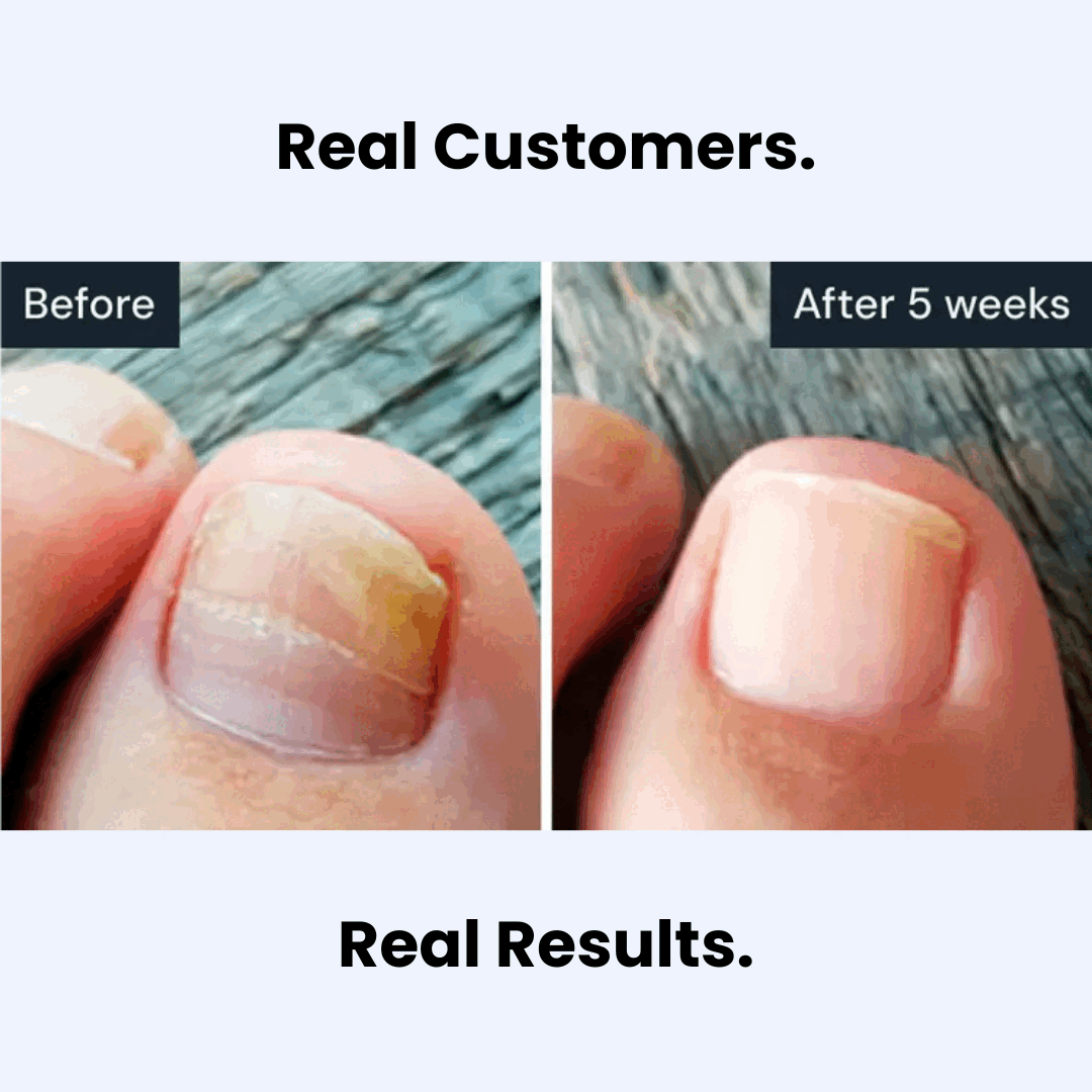 NailClear Pro+™ Obnovovací pero pro zdravější a krásnější nehty