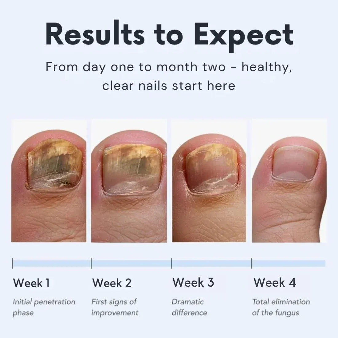 NailClear Pro+™ Obnovovací pero pro zdravější a krásnější nehty