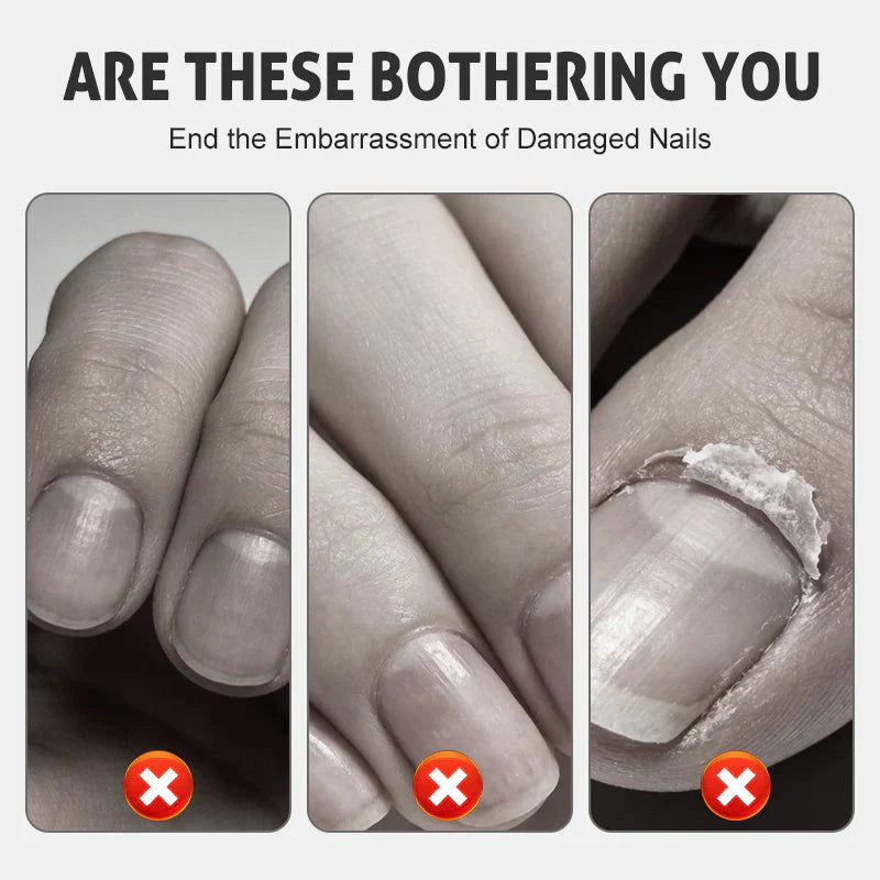 NourishNails™ Výživná péče pro opravu nehtů pro hladké a zdravé nehty