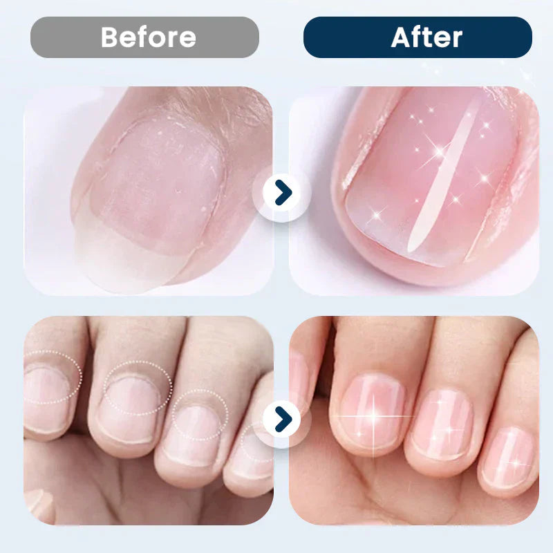 NourishNails™ Výživná péče pro opravu nehtů pro hladké a zdravé nehty